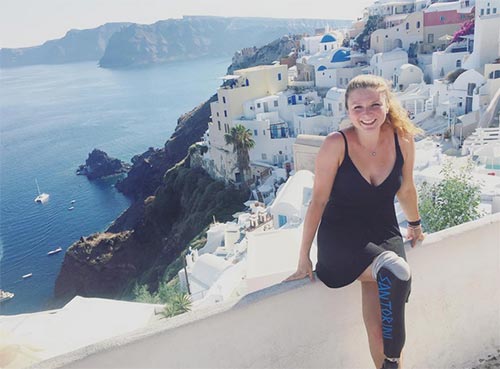 สาวพิการ