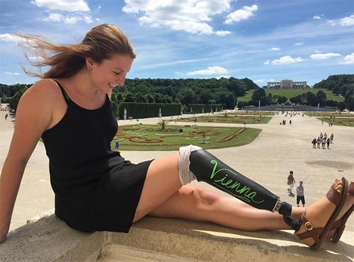 สาวพิการ