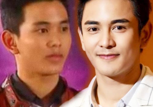 ดาราทำจมูก