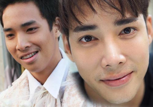 ดาราทำจมูก