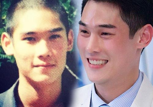 ดาราทำจมูก