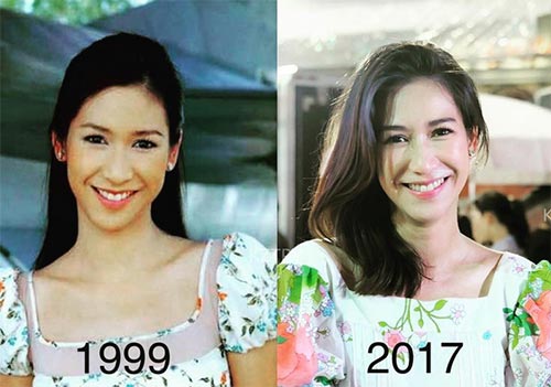 ดาราไม่ศัลยกรรม