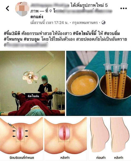 ศัลยกรรม