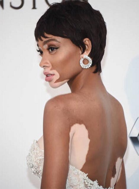 ทรงผมสั้น