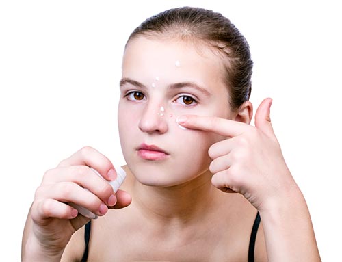 สิวไม่มีหัว