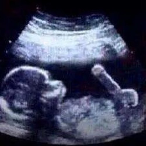 แพท เบนซ์