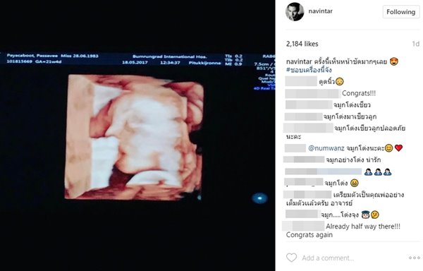 นาวิน ต้าร์ ไฮโซน้ำหวาน