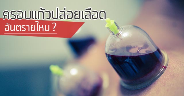 ครอบแก้ว