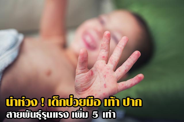 มือเท้าปาก