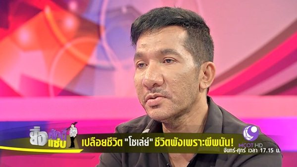 โชเล่ย์ ดอกกระโดน