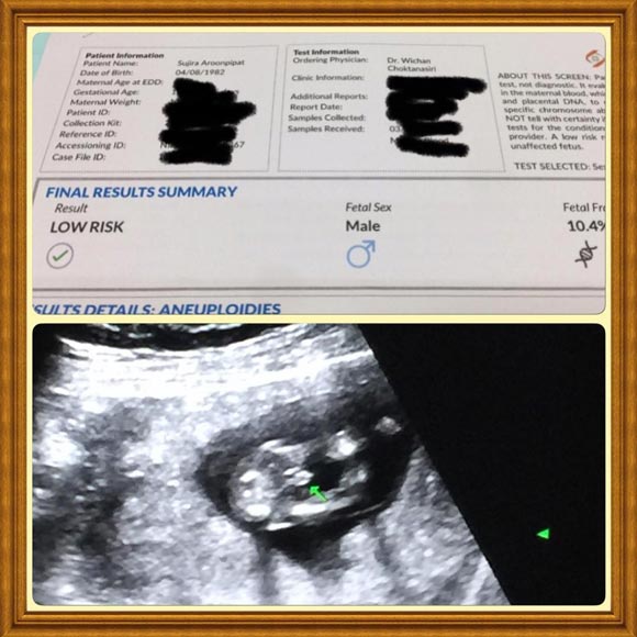 นุ้ย สุจิรา ท้องลูกคนที่ 2