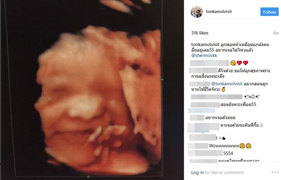 ต้น เชอรี่