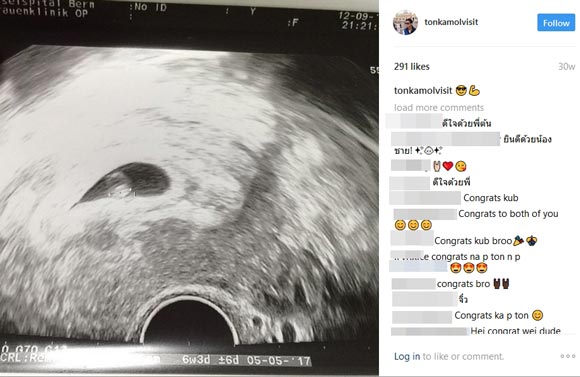 ต้น เชอรี่