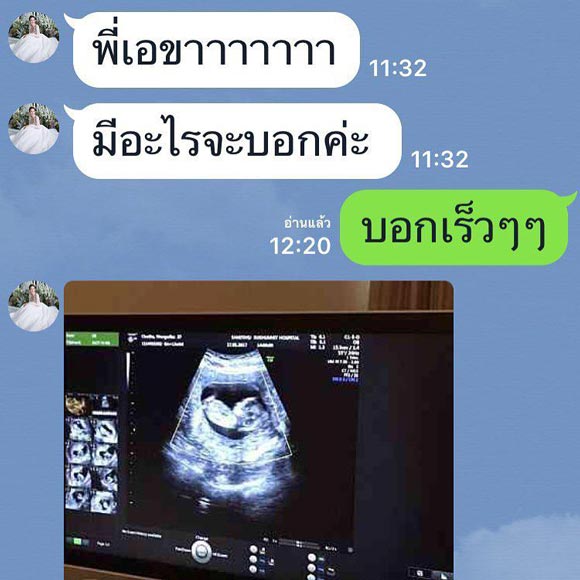 เนย โชติกา ท้อง