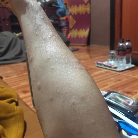 ก้อง Hive salon