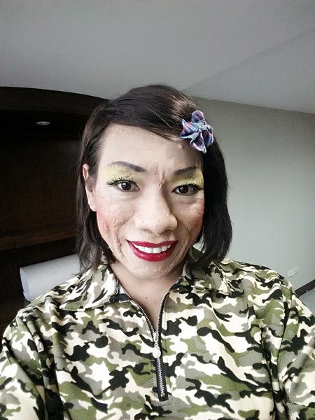 ไข่มุก ซุปตาร์ ป่วยมะเร็ง