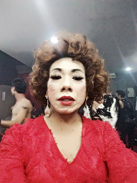 ไข่มุก ซุปตาร์ ป่วยมะเร็ง