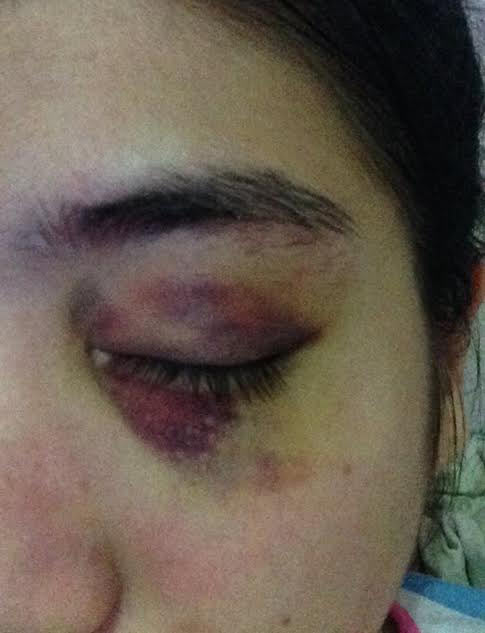 อาร์ท เทคมีเอ้าท์