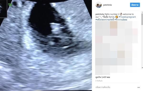 เพชร นาระ 