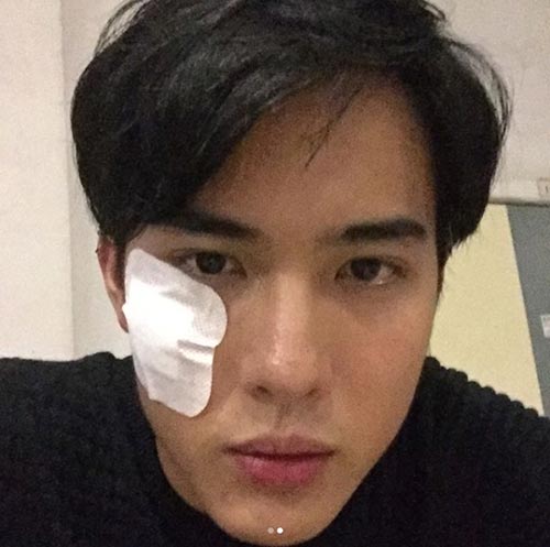 โก้ วศิน 