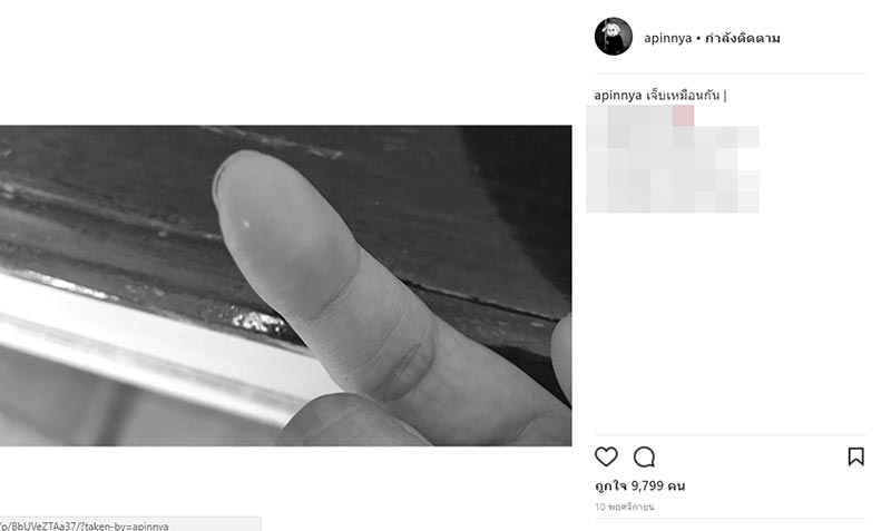 สายป่าน อาเบ