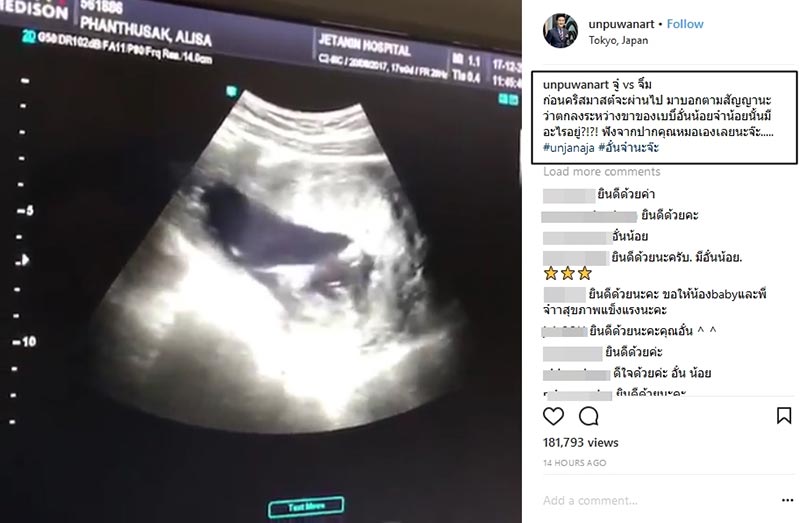 อั๋น จ๋า 