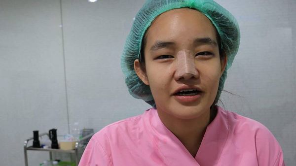  น้องคิตตี้ ศัลยกรรม