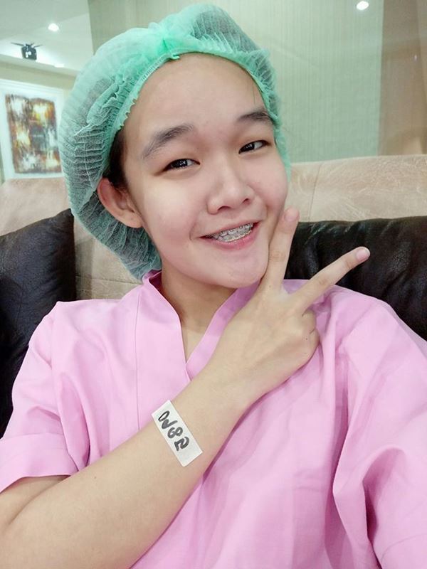  น้องคิตตี้ ศัลยกรรม