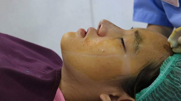 น้องคิตตี้ ศัลยกรรม