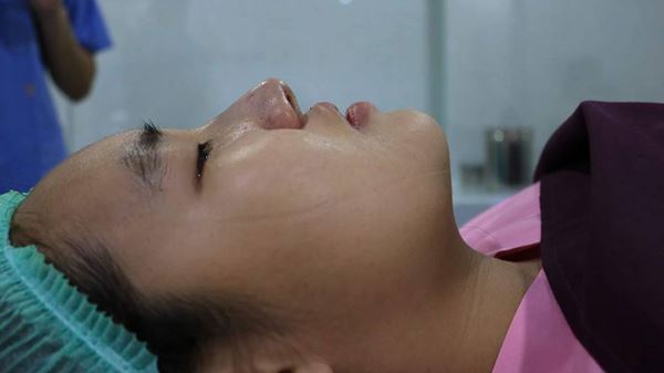 น้องคิตตี้ ศัลยกรรม