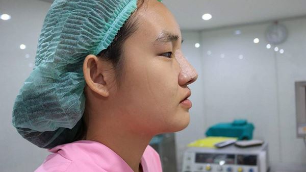 น้องคิตตี้ ศัลยกรรม