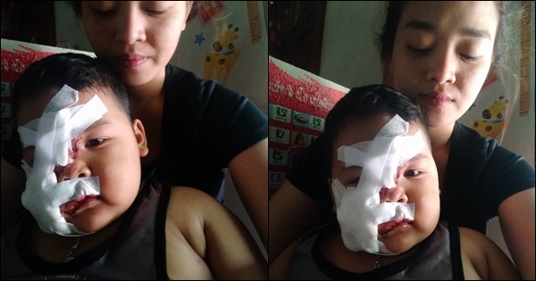 หมากัดเด็ก