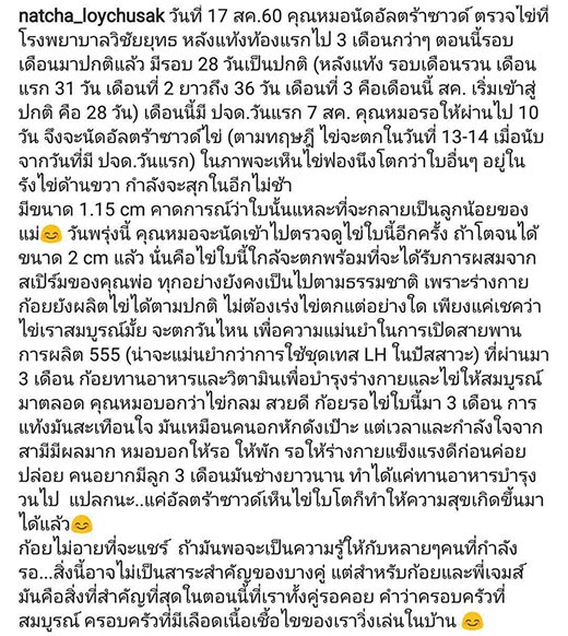 เจมส์ ครูก้อย