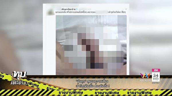 การฝังมุก
