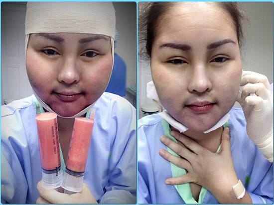 หญิงลี ศรีจุมพล