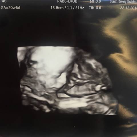 น้ำฝน กุลณัฐ ขอคลอดธรรมชาติ แม้ท้อง 10 เดือนแล้ว พร้อมเผยแคปชั่นฮา  