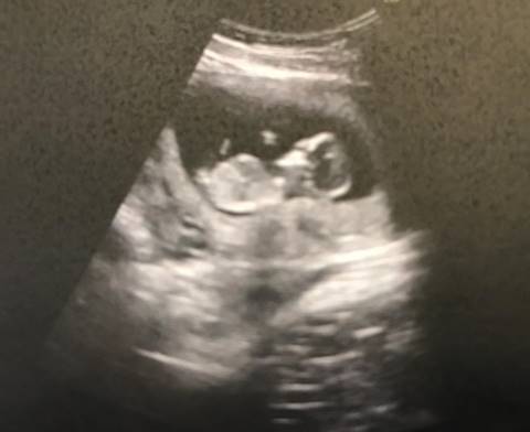 ดีเจอาร์ต