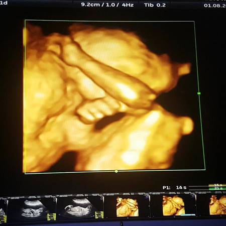 แอนดี้ เขมพิมุก 