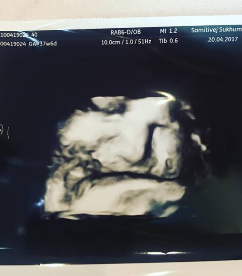 น้ำฝน กุลณัฐ ขอคลอดธรรมชาติ แม้ท้อง 10 เดือนแล้ว พร้อมเผยแคปชั่นฮา  