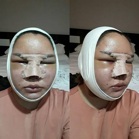 ทำศัลยกรรม