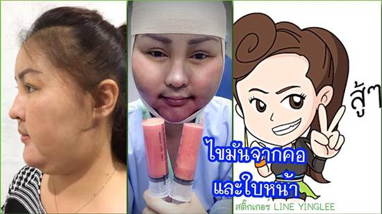 หญิงลี ศรีจุมพล