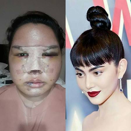 ทำศัลยกรรม