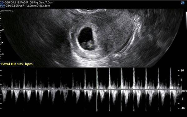 เตชินท์ จิรัฐชัย เฮลั่น ภรรยาตั้งท้องลูกคนแรก ได้เป็นพ่อคนแล้ว 