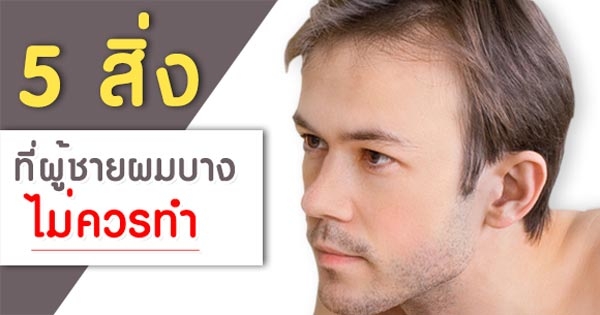ผู้ชายผมบาง
