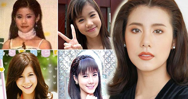 เอสเธอร์ สุปรีย์ลีลา ศัลยกรรม