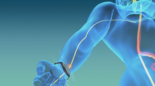 ReliefBand สายรัดข้อมืออัจฉริยะ