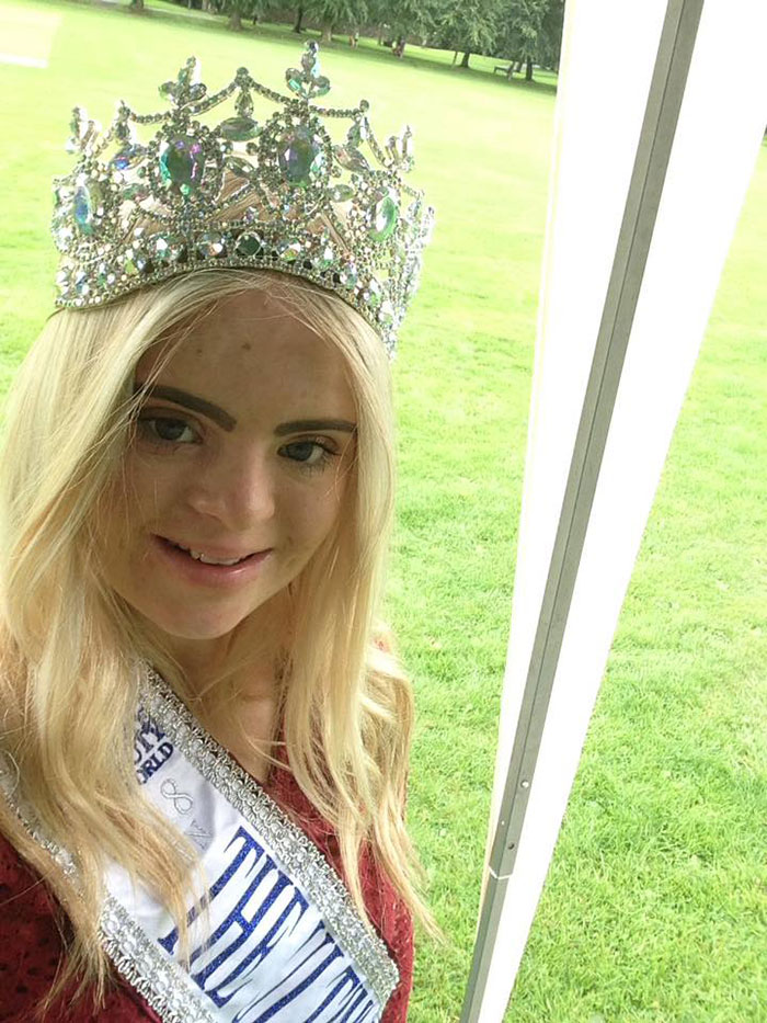 สาวดาวน์ซินโดรม คว้ามงกุฎนางงาม Teen Ultimate Beauty Of The World