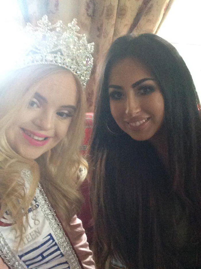 สาวดาวน์ซินโดรม คว้ามงกุฎนางงาม Teen Ultimate Beauty Of The World