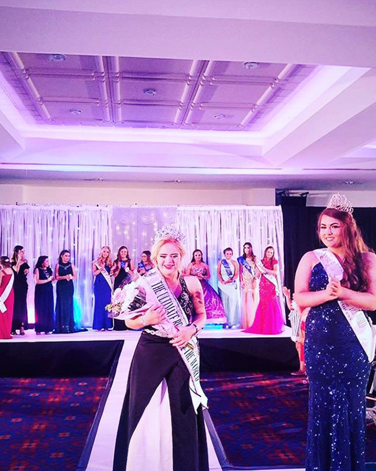 สาวดาวน์ซินโดรม คว้ามงกุฎนางงาม Teen Ultimate Beauty Of The World