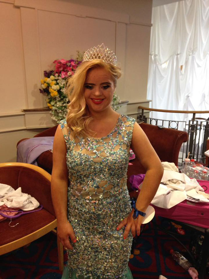 สาวดาวน์ซินโดรม คว้ามงกุฎนางงาม Teen Ultimate Beauty Of The World